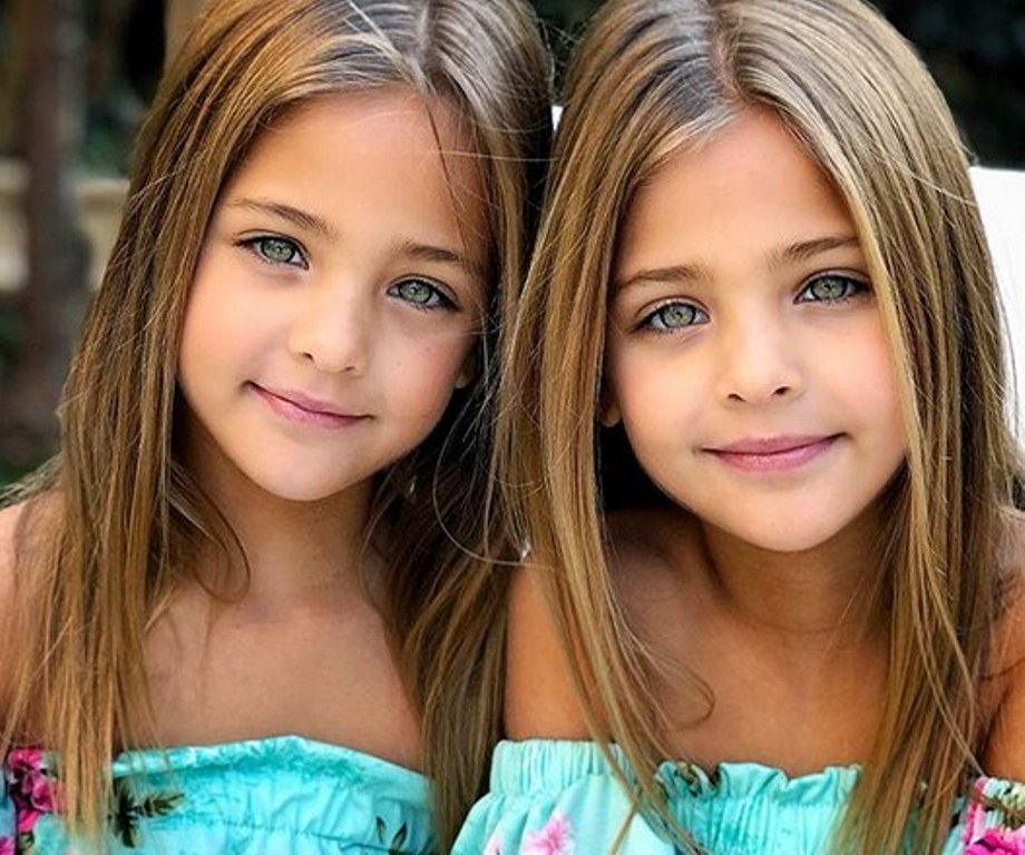 Bikin Terpesona, Dua Gadis Ini Disebut-Sebut Sebagai Saudara Kembar Identik Paling Cantik di  Dunia