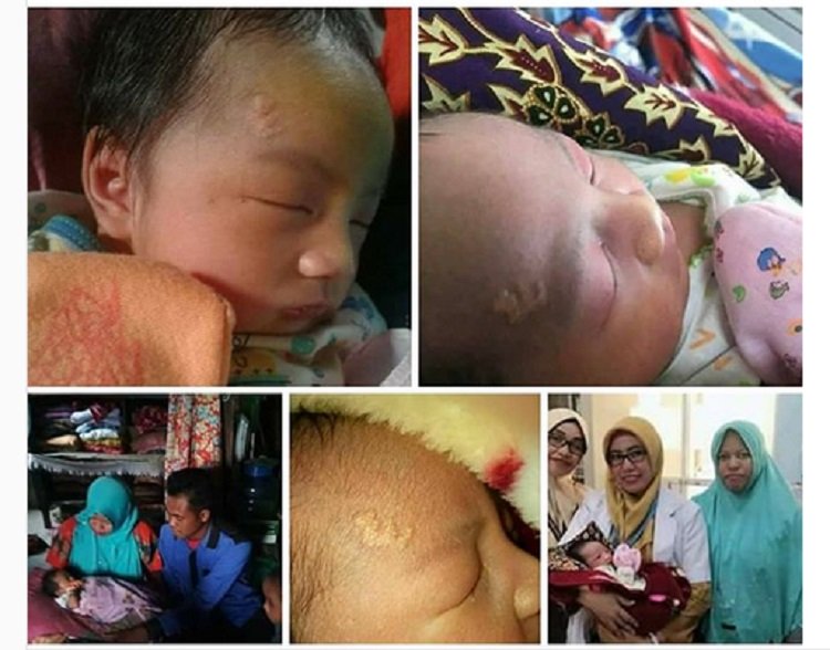 Ada Lafadz Allah di Dahi, Foto Bayi Ini Viral di Medsos