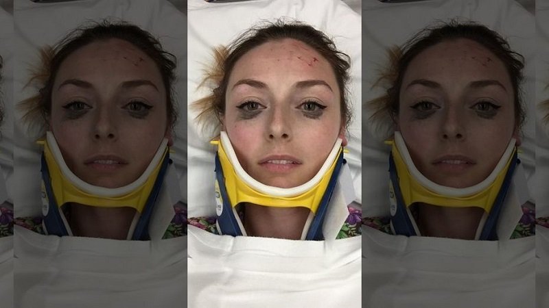 Eyeliner Tetap Sempurna Usai Kecelakaan, Ulasan Perempuan Ini Jadi Viral