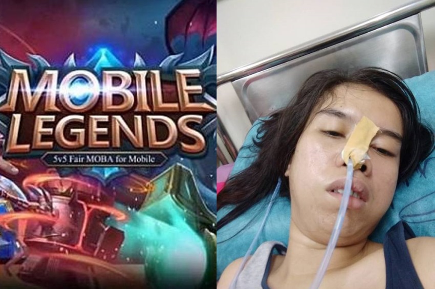 Kecanduan Mobile Legends, Wanita ini Alami Hal Tak Terduga, Sampai Dirawat di Rumah Sakit!