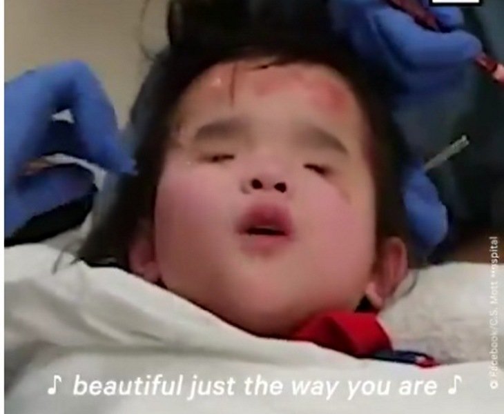 Video Viral Bocah Perempuan Tak Bermata Bernyanyi saat Dioperasi, Netizen Auto Nangis