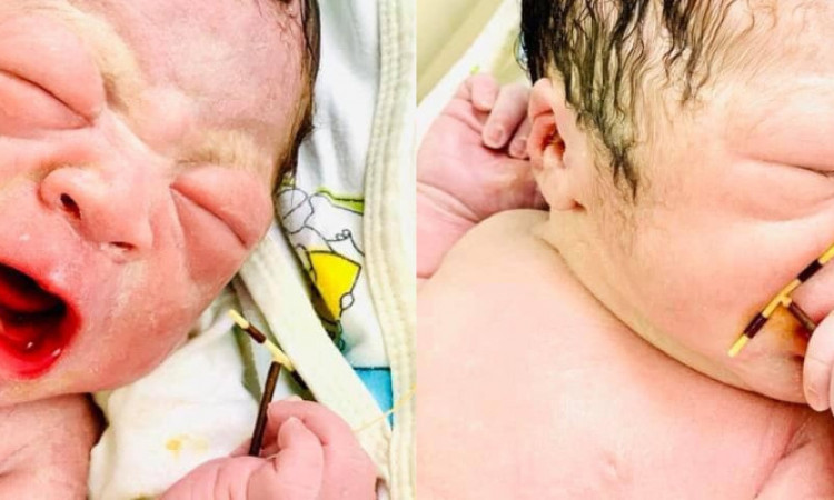 Viral Bayi Baru Lahir Genggam Alat Kontrasepsi Ibunya
