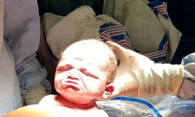 Viral Bayi Lahir dengan Wajah Cemberut